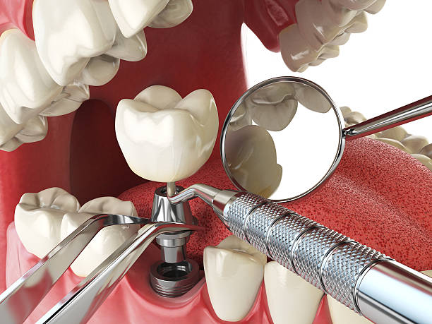 Best Same-Day Emergency Dental Services in Tilton Northfield, NH